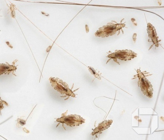 Lús - ákall til foreldra og forráðamanna